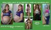 SUCESSO HERBALIFE